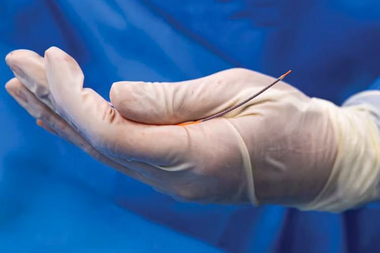 Stent động mạch vành và thủy tinh thể nhân tạo là hai nhóm vật tư y tế có giá trị lớn được đưa vào tổ chức mua sắm tập trung cấp quốc gia từ năm 2027. Ảnh: Tâm Anh