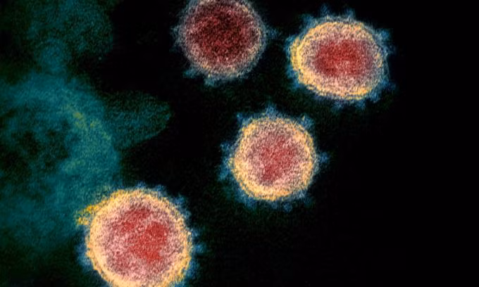 Hình ảnh virus SARS-CoV-2 được phân lập ở một bệnh nhân Covid-19 ở Mỹ. Ảnh: Reuters.