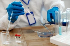 Gói thầu: Mua vật tư y tế tiêu hao: 67 phần (mục)