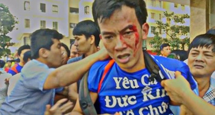 Đòi tổ chức “hội nghị nhà chung cư”, người dân The Era Town bị côn đồ hành hung ảnh 1