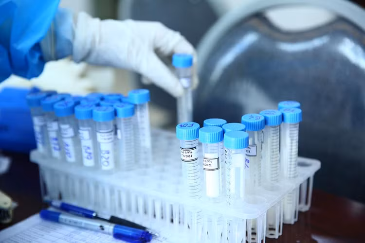 Năm 2020 - 2021, có 21 gói thầu mua sắm trang thiết bị, vật tư y tế, sinh phẩm... tại Sở Y tế tỉnh Hậu Giang chưa đăng tải thông báo kết quả lựa chọn nhà thầu theo quy định. Ảnh minh họa: Nhã Chi