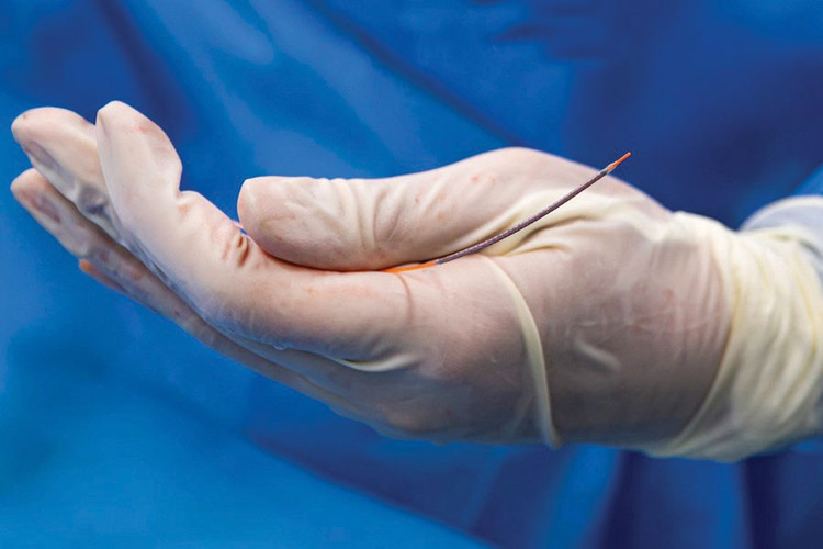 Stent động mạch vành và thủy tinh thể nhân tạo là hai nhóm vật tư y tế có giá trị lớn được đưa vào tổ chức mua sắm tập trung cấp quốc gia từ năm 2027. Ảnh: Tâm Anh