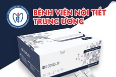 Bệnh viện Nội tiết Trung ương thông báo nhu cầu mua các danh mục thực phẩm chức năng, thiết bị y tế