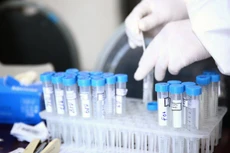 Nhiều đơn vị chống dịch trên cả nước đã sử dụng sản phẩm kit xét nghiệm Covid-19 RT-PCR do Công ty TNHH Thiết bị B.D.E cung cấp. Ảnh minh họa: Tiên Giang