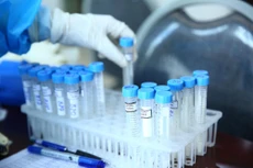 Năm 2020 - 2021, có 21 gói thầu mua sắm trang thiết bị, vật tư y tế, sinh phẩm... tại Sở Y tế tỉnh Hậu Giang chưa đăng tải thông báo kết quả lựa chọn nhà thầu theo quy định. Ảnh minh họa: Nhã Chi