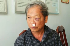 Kon Tum: Vụ nhà báo VTV bị hành hung: Đoàn liên ngành kiểm tra có dấu hiệu khai thác