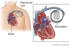 Ảnh chỉ mang tính minh họa. Nguồn Internet
