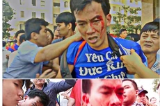 Vụ xô xát, đổ máu tại chung cư Era Town - Ảnh cắt từ video 