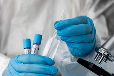 Ngày 4/12, Hà Nội ghi nhận 628 ca dương tính với SARS-CoV-2