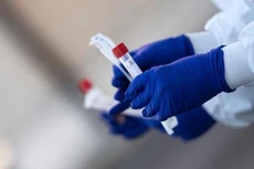 Chiều ngày 24/8, Hà Nội ghi nhận 09 ca mắc Covid -19 mới, số mắc trong ngày là 67 ca