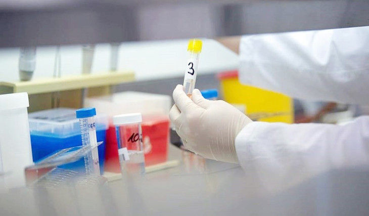 Xét nghiệm mắc COVID-19