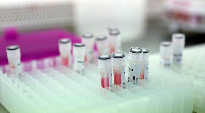 Mẫu xét nghiệm Covid-19 tại TPHCM