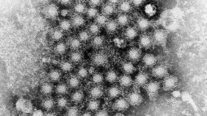 Hình ảnh dưới kính hiển vi của virus viêm gan chưa xác định. Ảnh:Sky News