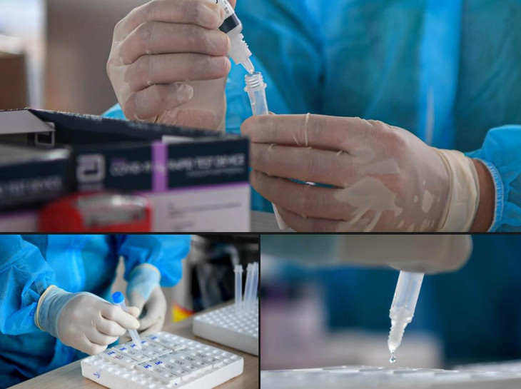 Phương pháp được đội ngũ nhân viên y tế sử dụng là phương pháp test nhanh kháng nguyên để xác định có nguy cơ nhiễm SARS-CoV-2 hay không, kết quả sẽ có sau đó từ 15-30 phút.