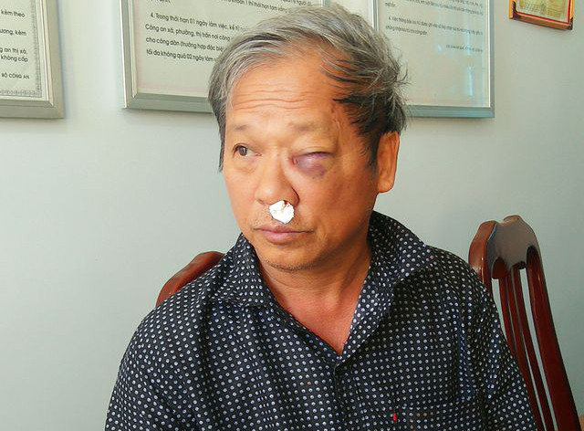 Kon Tum: Vụ nhà báo VTV bị hành hung: Đoàn liên ngành kiểm tra có dấu hiệu khai thác